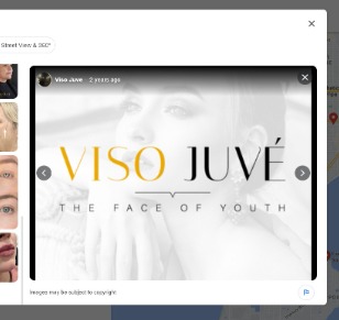 Viso Juve reviews