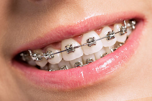 McKinney Orthodontics reviews