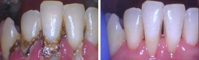 Patel and Dornhecker Dental Wellness Center photo