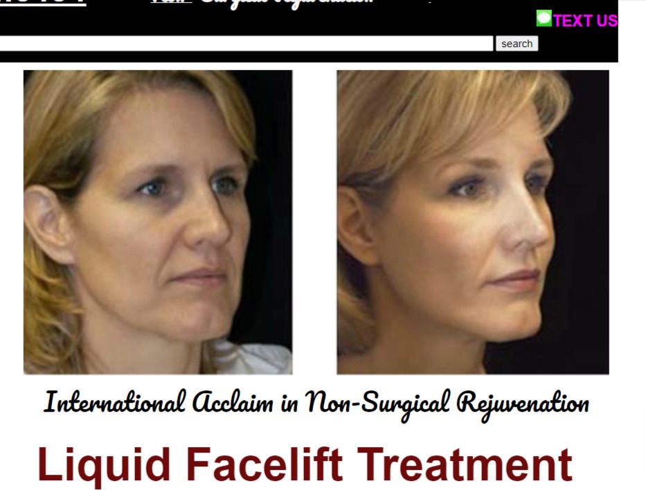 Wrinkle Fillers Medical Spa reviews