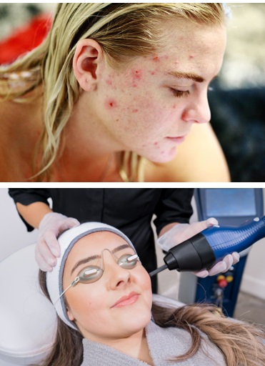 Canadian Optic & Laser Clinic, COL Clinic (Laser Skin Rejuvenation) photo