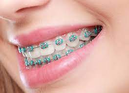 Smile Doctors Orthodontics - Mesquite reviews