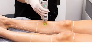 Charlotte Skin and Laser reviews
