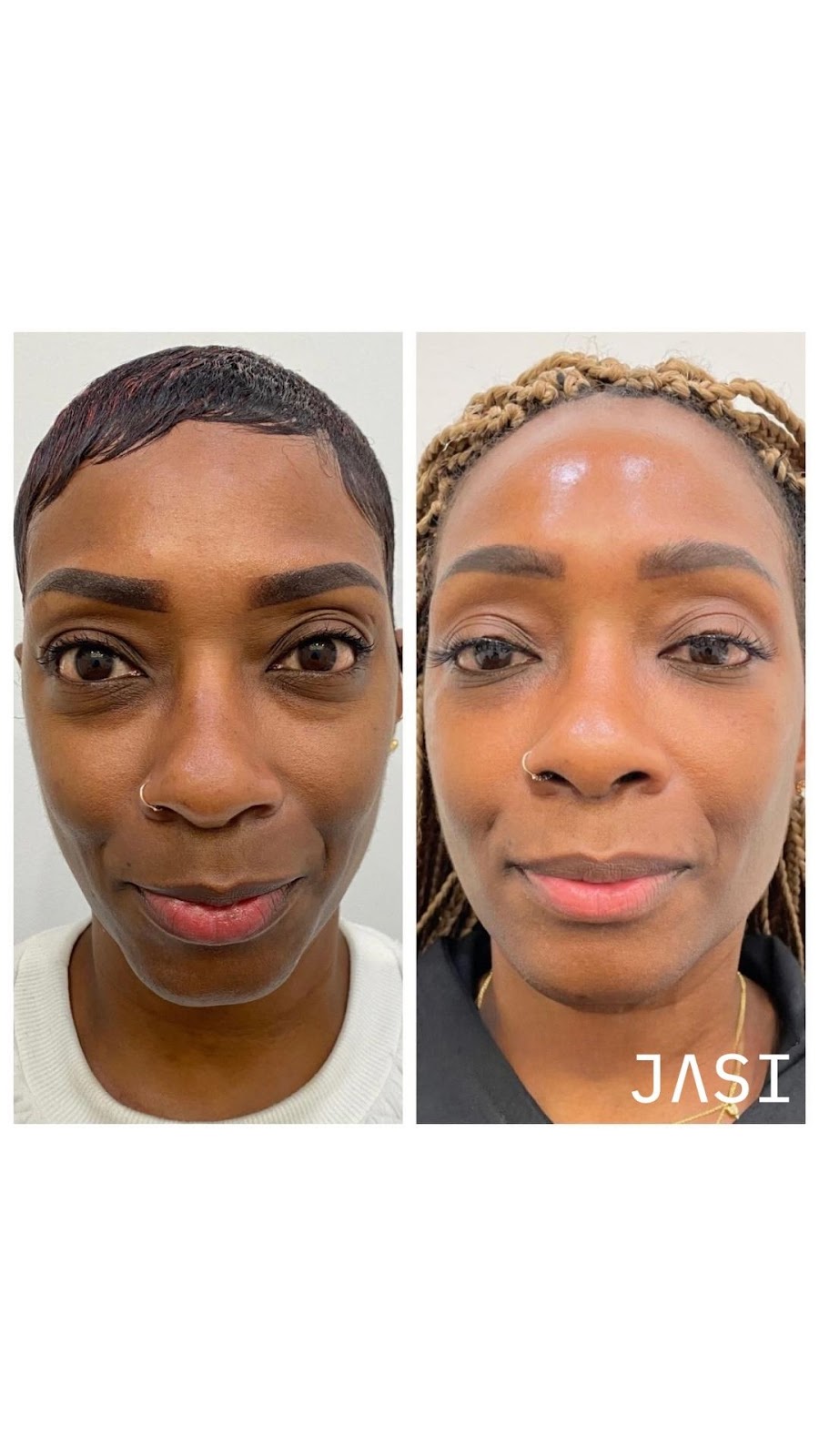 JASI Skin + Wellness Med Spa reviews