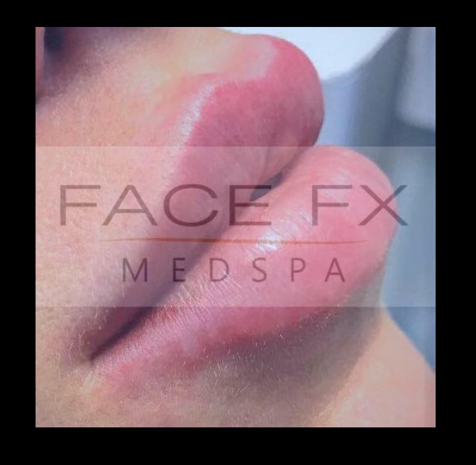 Face FX Medspa reviews