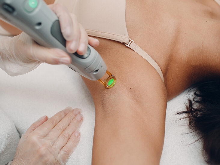 Corlase Electrolysis & Laser reviews