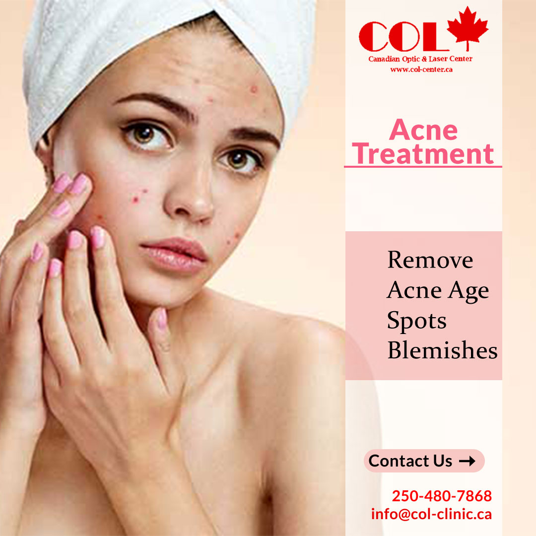 Canadian Optic & Laser Clinic, COL Clinic (Laser Skin Rejuvenation) photo