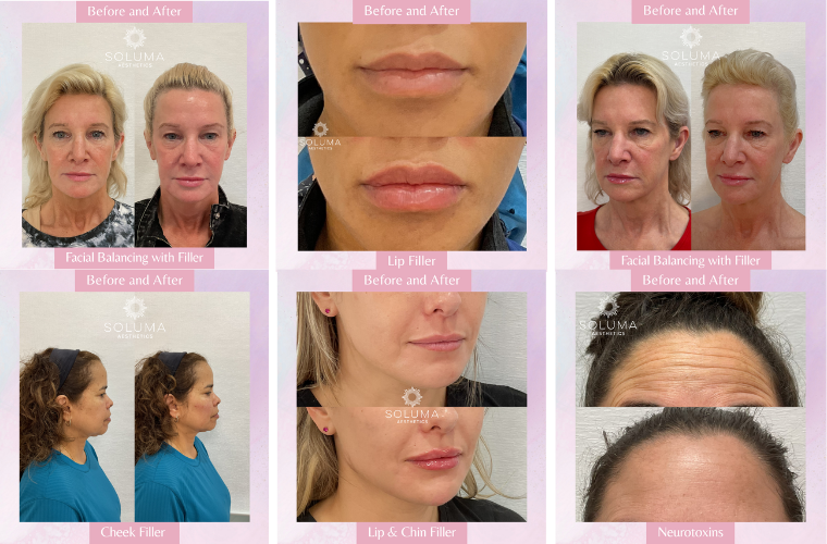 Soluma Aesthetics® Med Spa - Orlando photo