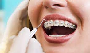 Meadowlands Orthodontics reviews