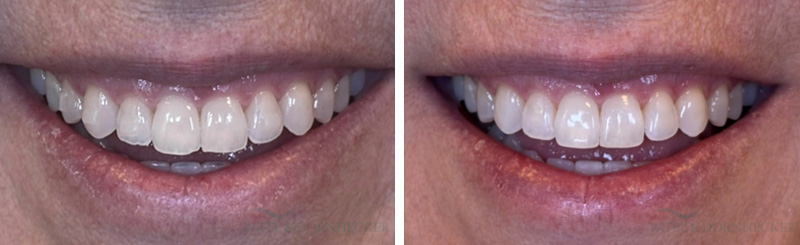 Patel and Dornhecker Dental Wellness Center photo