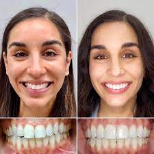 Beach Cities Orthodontics reviews