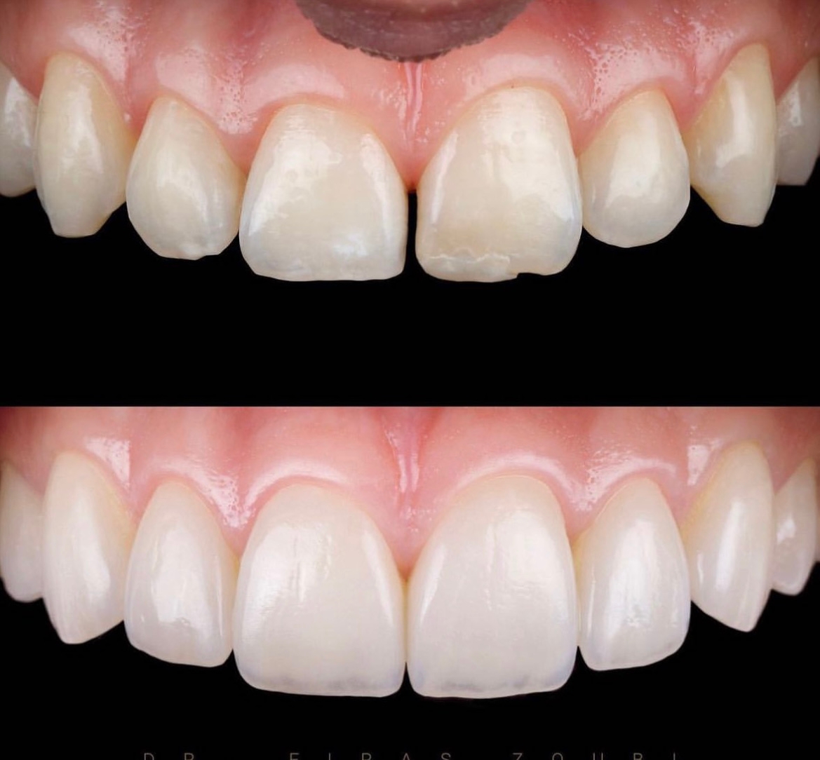 Smile Point Dental - Dental Office Oakville photo