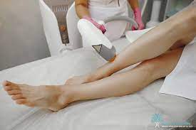 Electrolysis by Lisa reviews