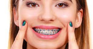 Comfort Dental Braces West reviews