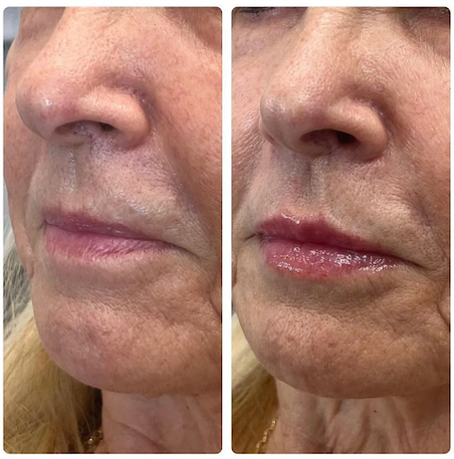 Beyond Harmony Medical Spa & Luxury Aesthetics photo