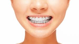 Franklin Square Orthodontics reviews